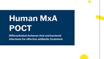 Human MxA POCT