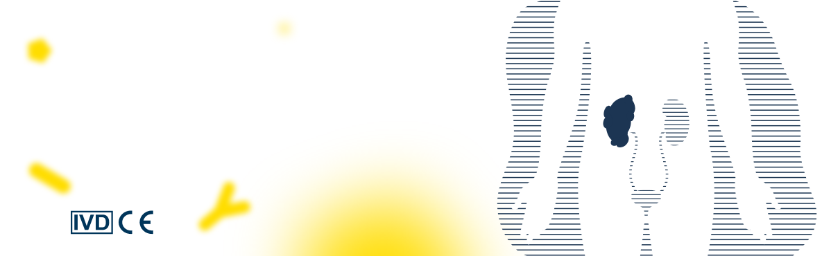 Human Uromodulin ELISA